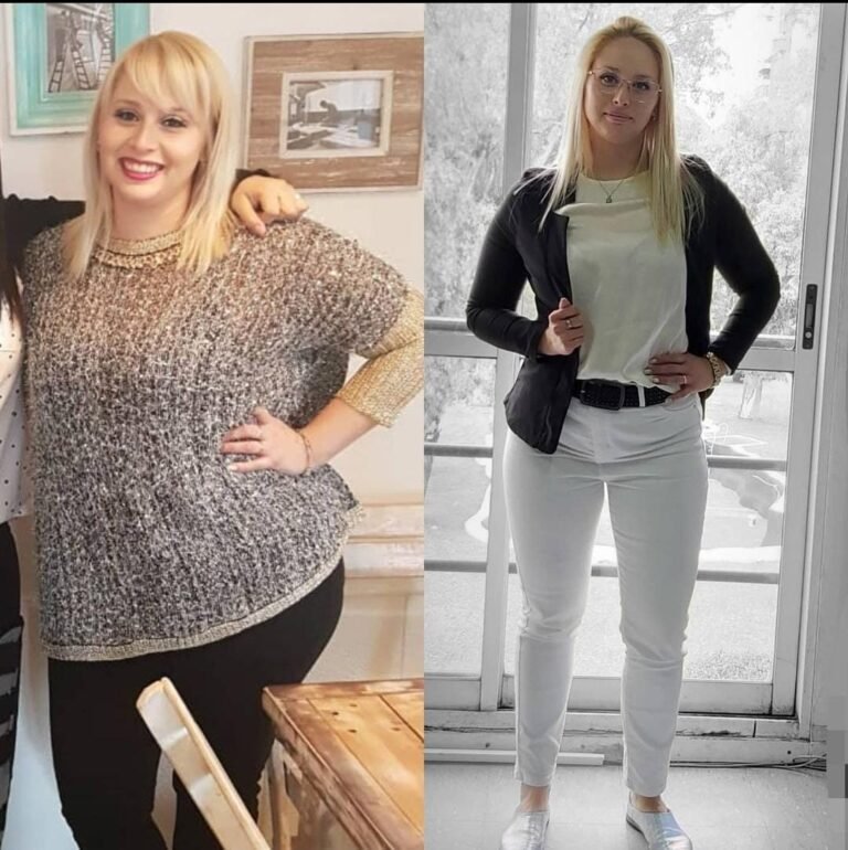 Nayla, 34 años bajó 20kg en 3 meses y logró una impresionante desinflamación