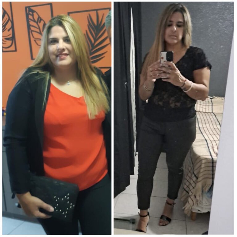 Sole, 43 años perdió 20kg en 3 meses